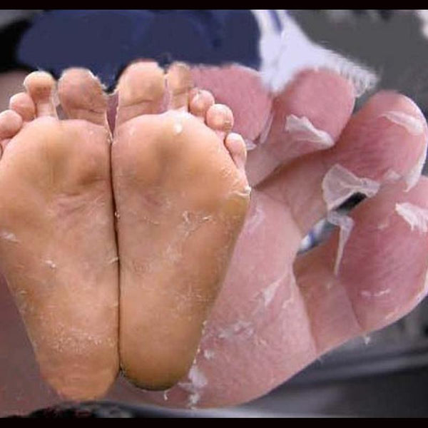 Baby Foot Peeling
