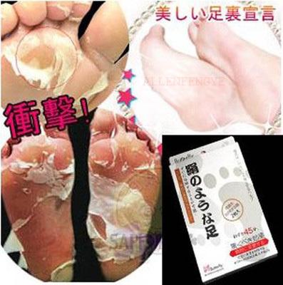 Baby Foot Peeling