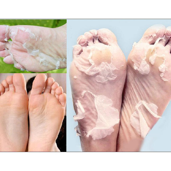 Baby Foot Peeling